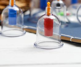 Cupping therapy of traditional Chinese medicine